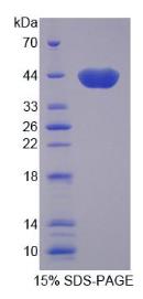 SDS-PAGE (RTKN-8057H).jpg